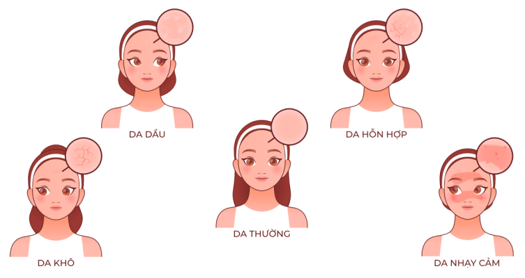 Các loại da